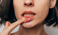 Lady shows inflamed gum tissue