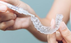 Lady uses take-home teeth whitening kit