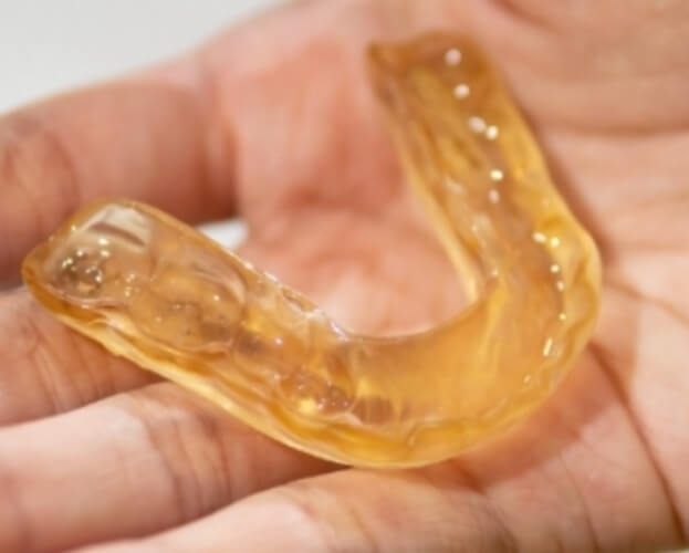 Hand holding nightguard for bruxism