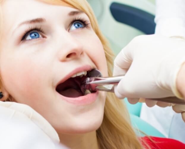 Woman receiving wisdom tooth extraction
