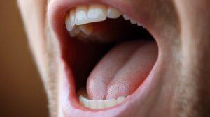 up-close view of a person’s mouth